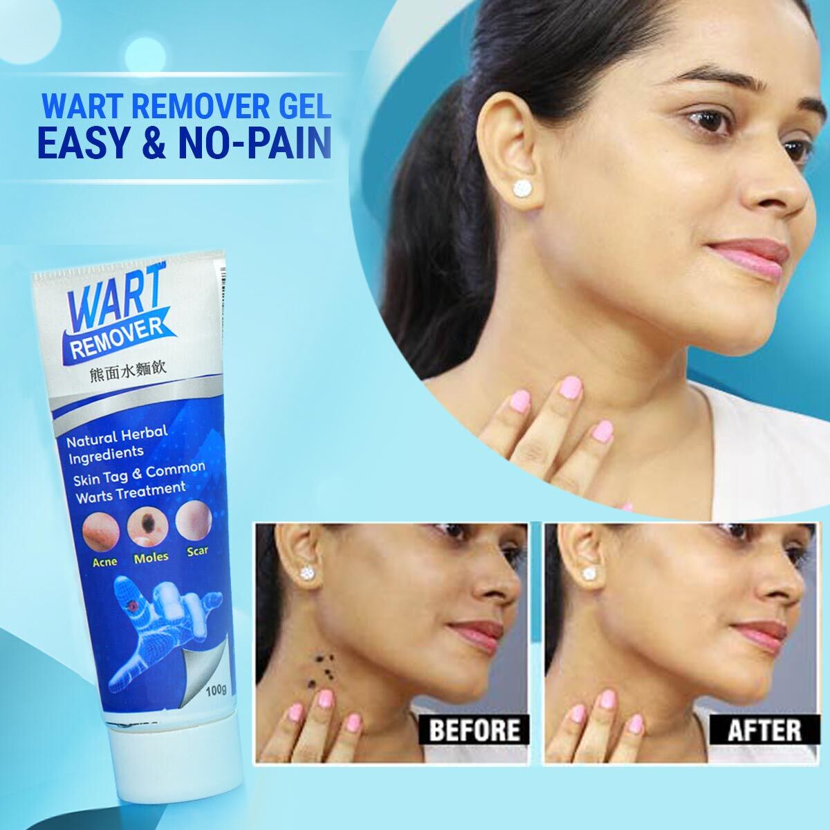 💥WARTS REMOVER CREAM💥 50% OFF FOR TODAY🤩